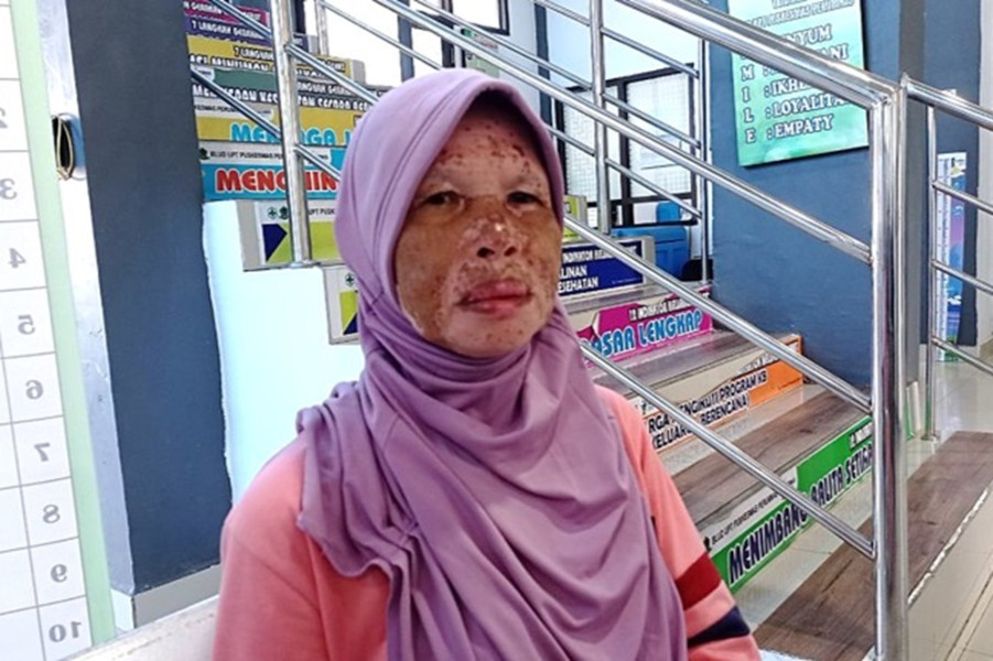 Pengobatan Diabetes Gratis Berkat JKN, Tumiyem Tetap Sehat di Usia Senja